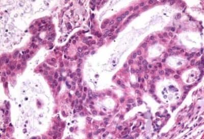 Immunohistochemistry: Somatostatin R1/SSTR1 Antibody [NBP3-14480]